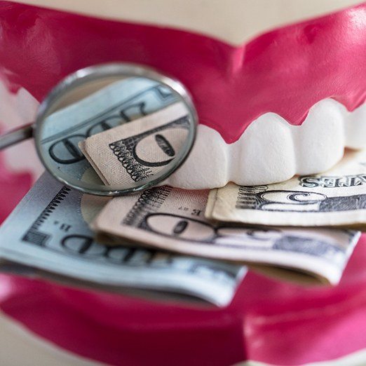 Denture model with money gripped between the teeth
