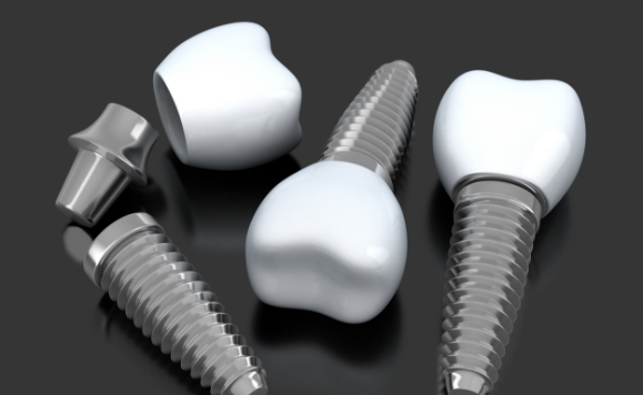 Three animated dental implant supported dental crowns