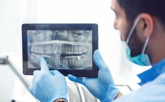 Dentist pointing to dental x-rays on tablet computer
