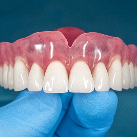 Denture for upper arch balanced on hand in blue glove