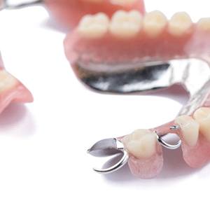 Two partial dentures with metal attachments against white background