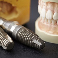 Two dental implants resting next to denture model