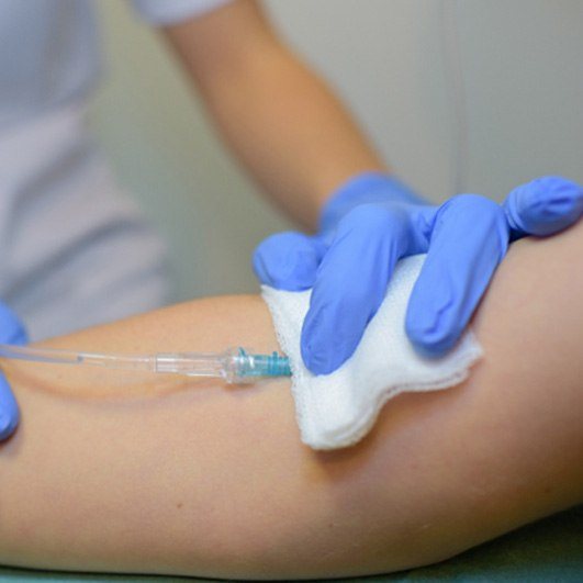 Oral surgery team member inserting IV into patient’s arm