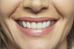 bone grafting in houston prepares the jaw for implants