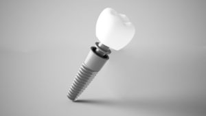Dental implant and restoration isolated against gray background