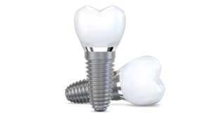 Two dental implants isolated against white background