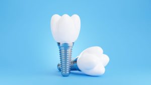 Two dental implants and crowns against blue background