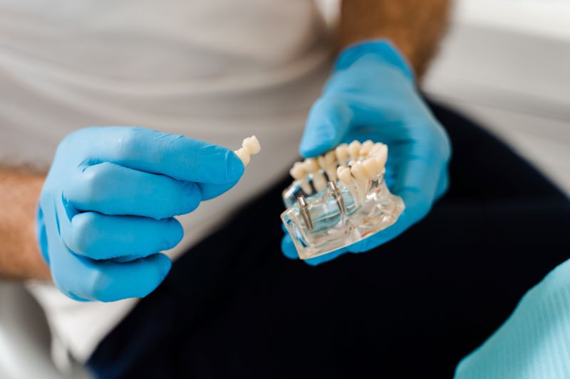 What to Expect During Your Dental Implant Consultation