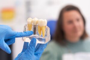 Gloved hand pointing at dental implant model with patient in background